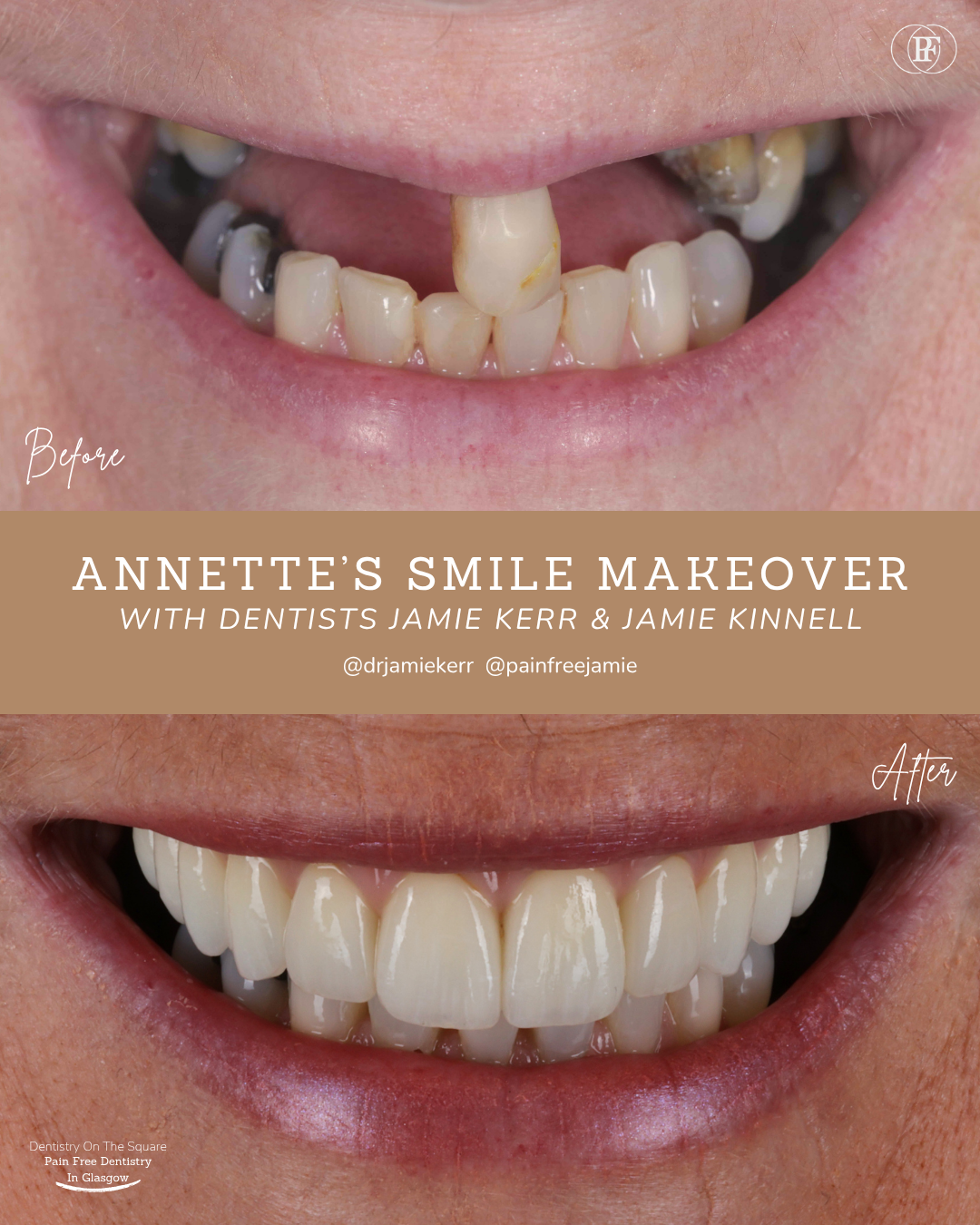 Annette S Smile Story With Jamie Kerr And Jamie Kinnell