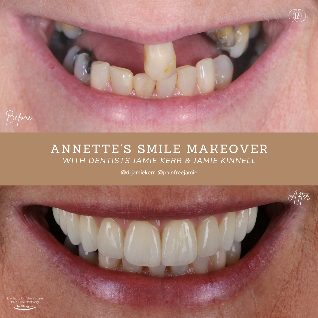 Annette S Smile Story With Jamie Kerr And Jamie Kinnell X Px