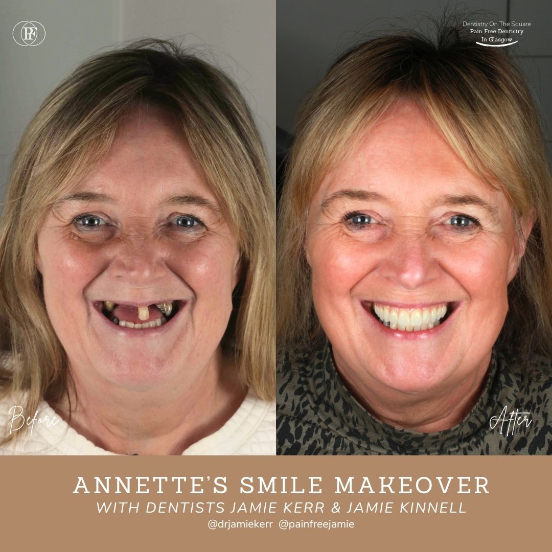 Annette S Smile Story With Jamie Kerr And Jamie Kinnell X Px