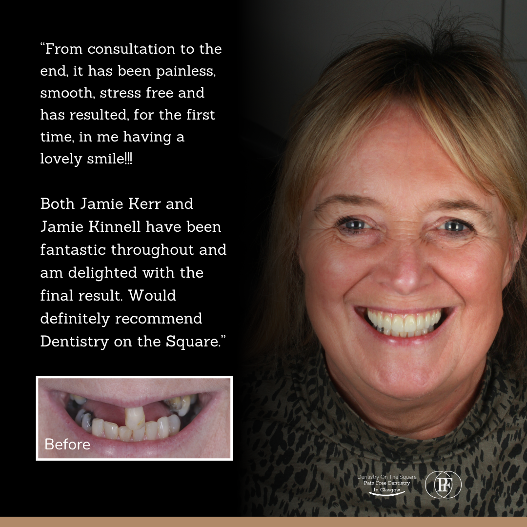 Annette S Smile Story With Jamie Kerr And Jamie Kinnell X Px