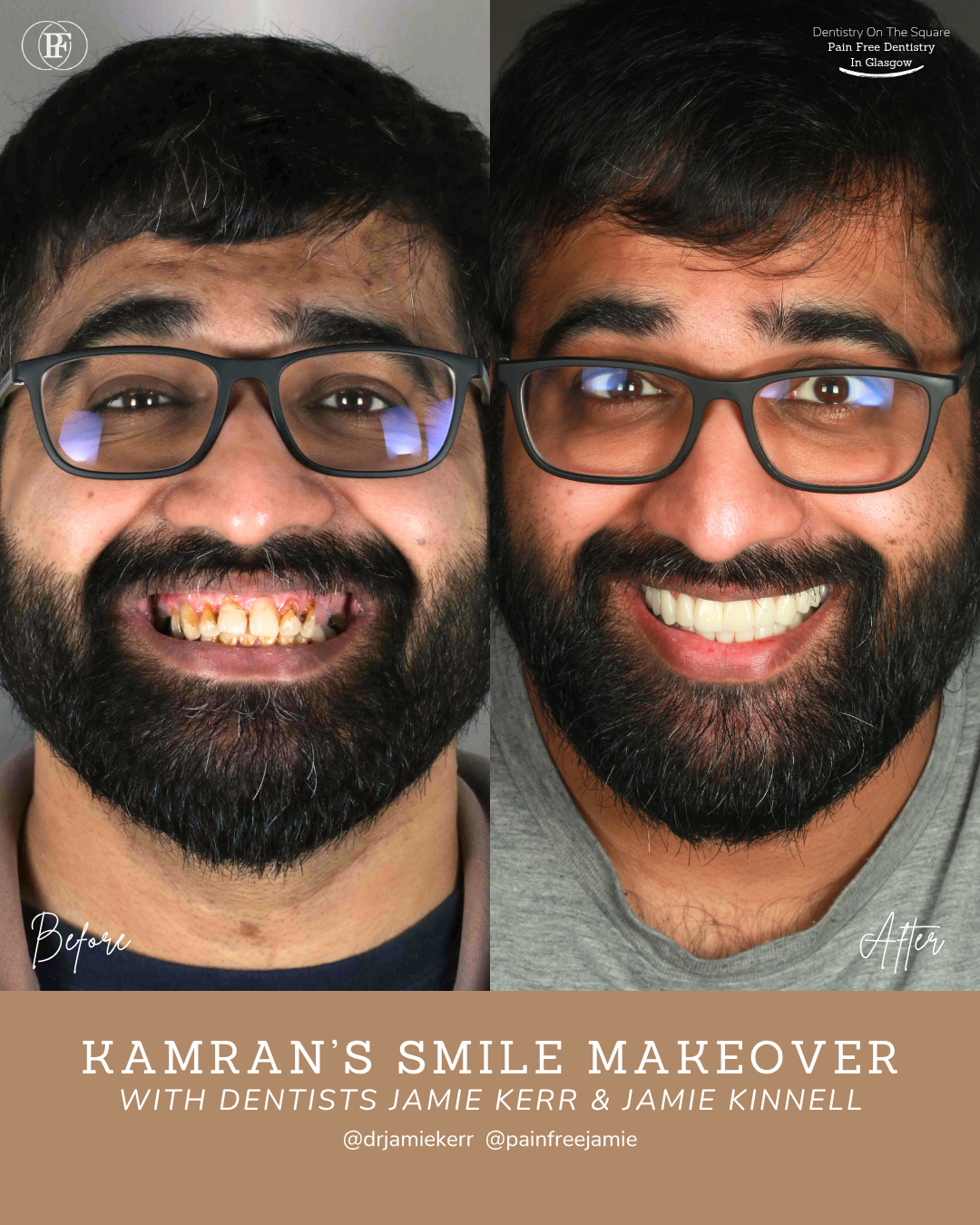 Dentistry On The Square, Pain Free Dentist Glasgow - Kamran's Smile Story Kamran S Smile Story With Jamie Kerr And Jamie Kinnell
