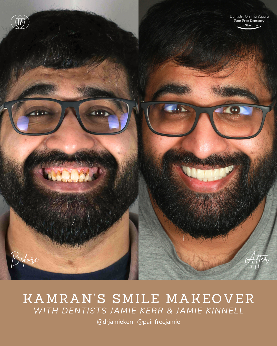 Kamran's Smile Story  With Jamie Kerr And Jamie Kinnell