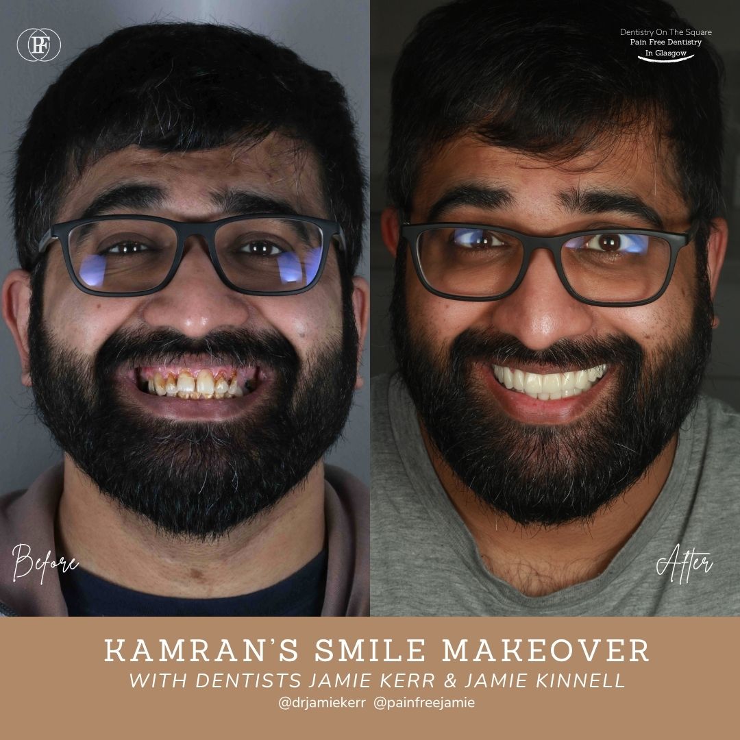 Kamran S Smile Story With Jamie Kerr And Jamie Kinnell X Px