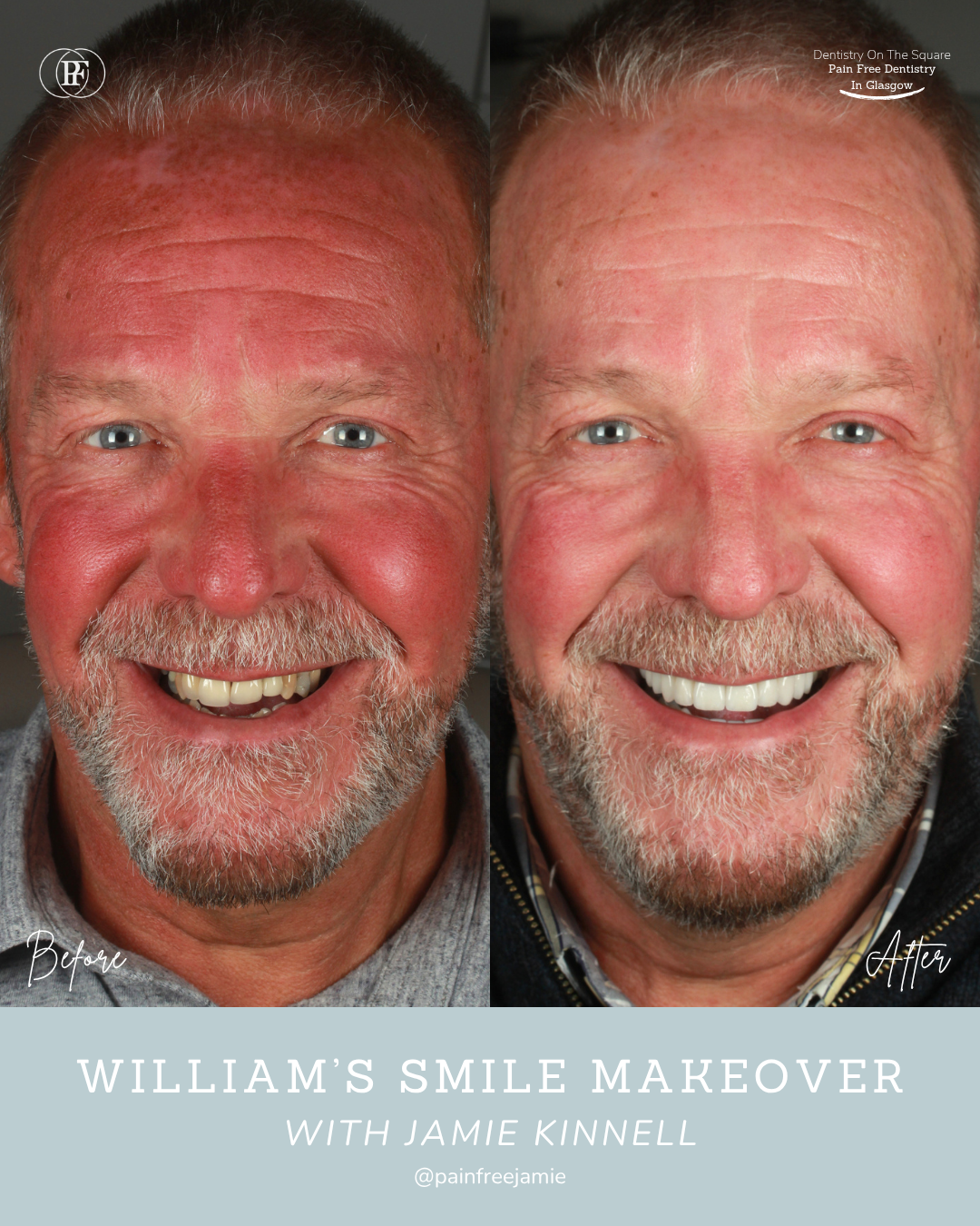 William S - Jamie Kinnell Smile Makeover Portrait