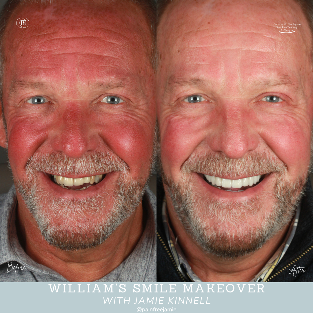  William's Smile Story jamie Kinnell X Px X Px