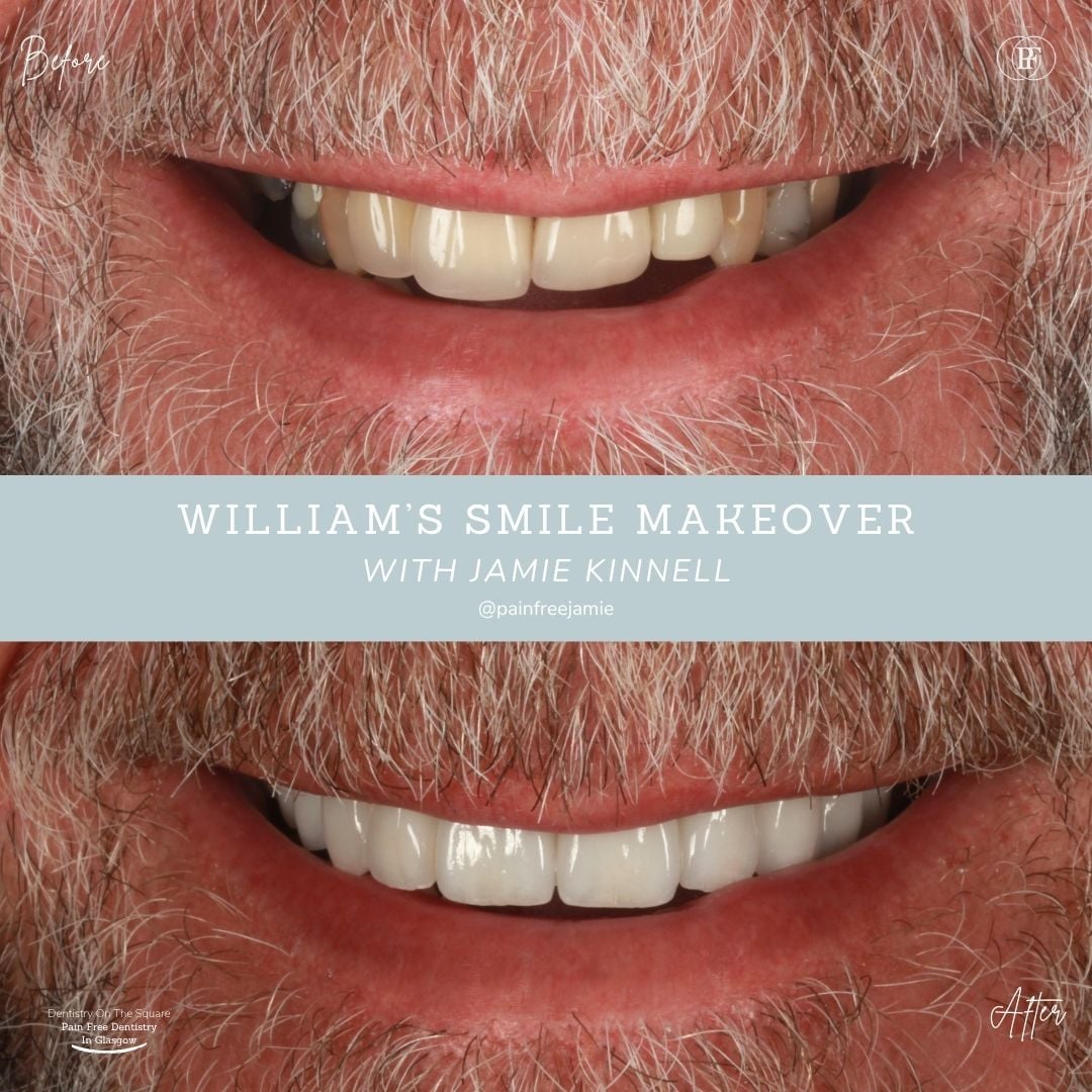 William S - Jamie Kinnell Smile Makeover Portrait X Px