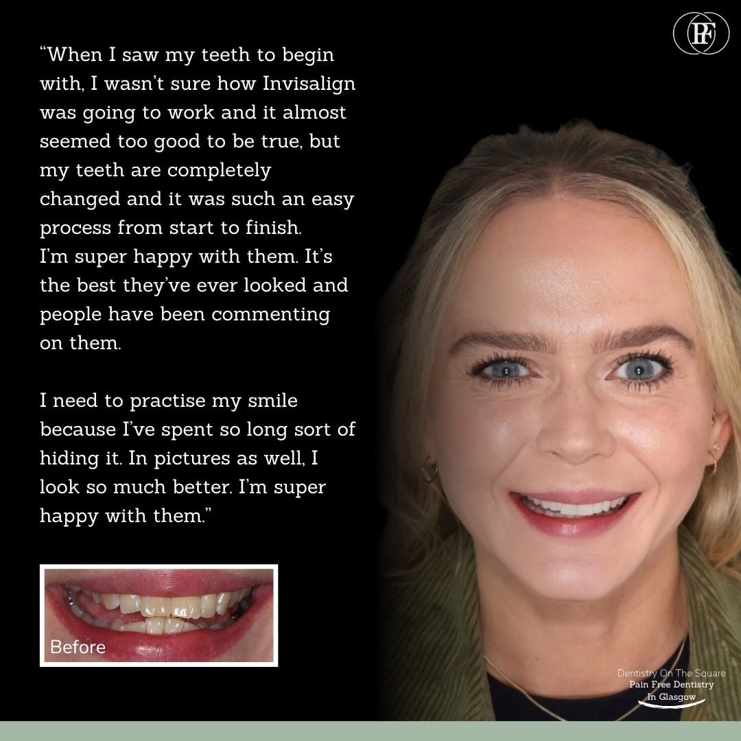 Dentistry On The Square, Pain Free Dentist Glasgow - Samantha's Smile Story Samantha S Smile Story With Andy Dots