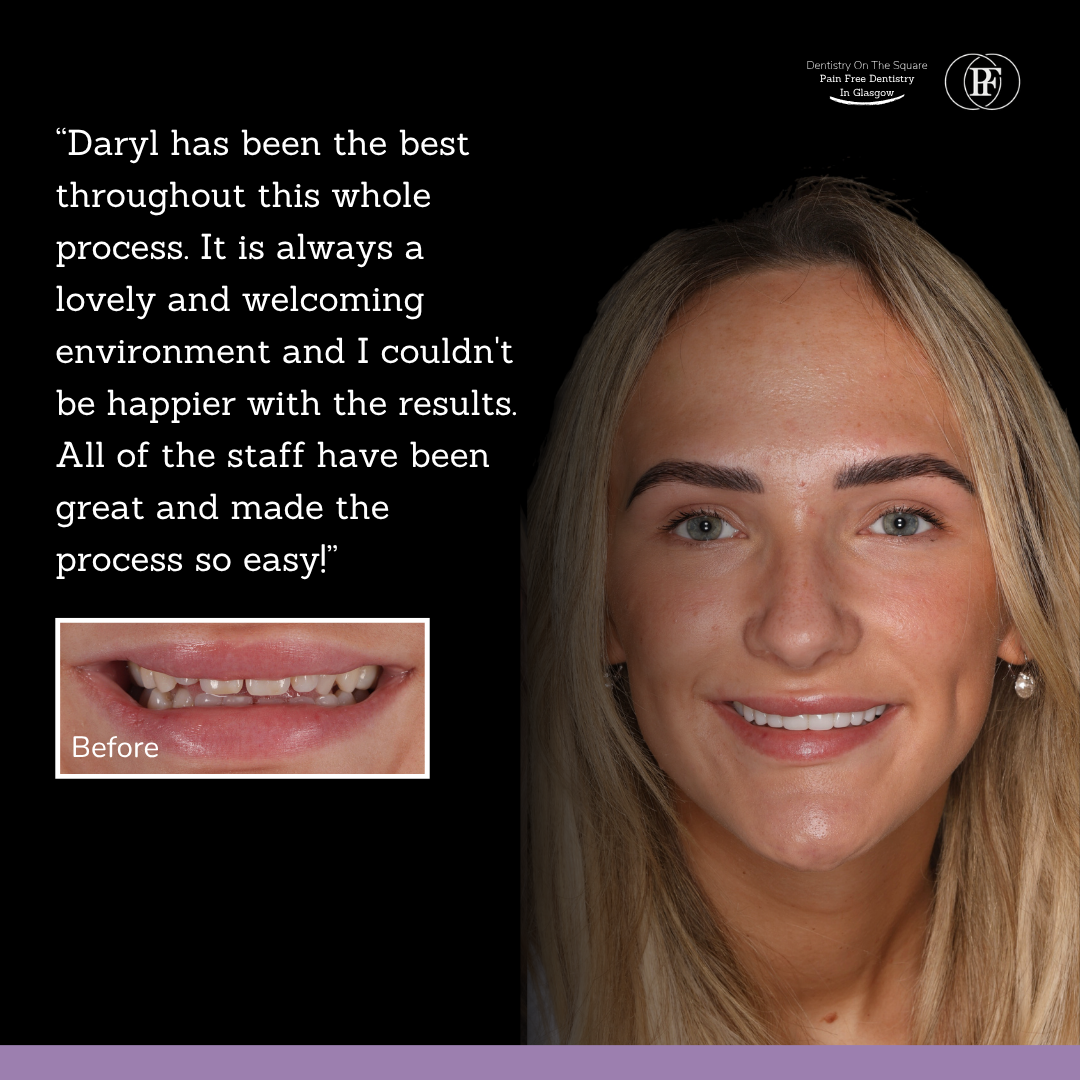 Dentistry On The Square, Pain Free Dentist Glasgow - Sophie's Smile Story Sophie S Smile Story With Daryl Mclay Posts