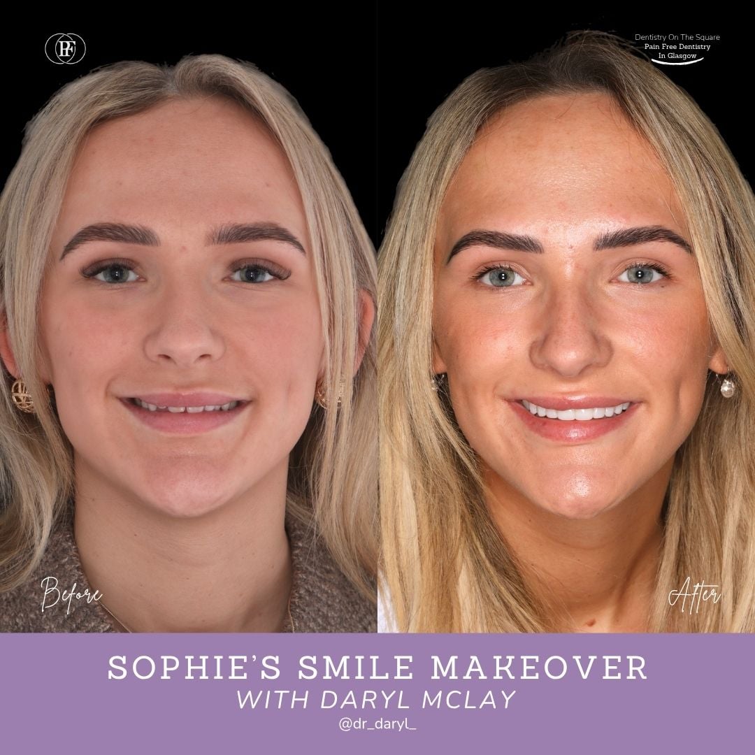 Sophie S Smile Story With Daryl Mclay Posts
