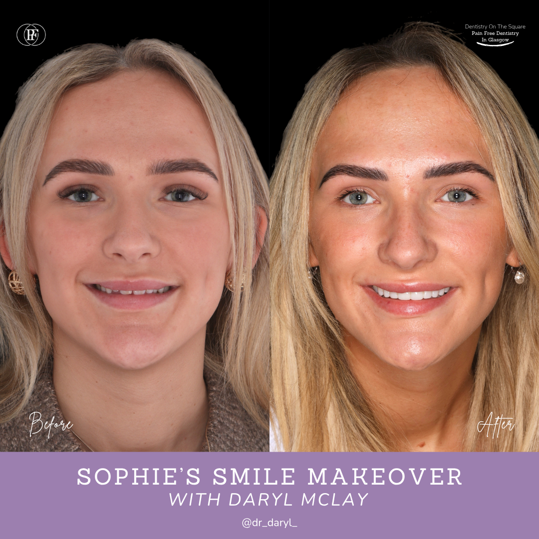 Sophie S Smile Story With Daryl Mclay Posts