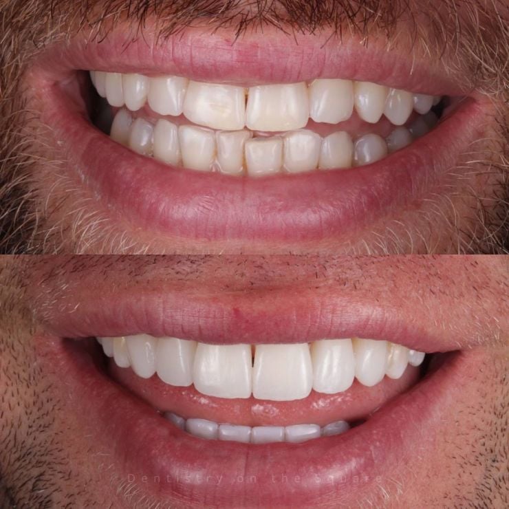 Transforming Smiles