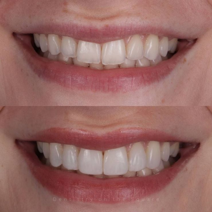 Transforming Smiles