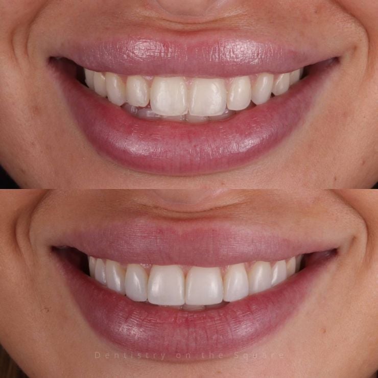 Transforming Smiles