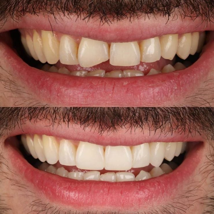 Dentistry On The Square, Pain Free Dentist Glasgow - Smile Gallery