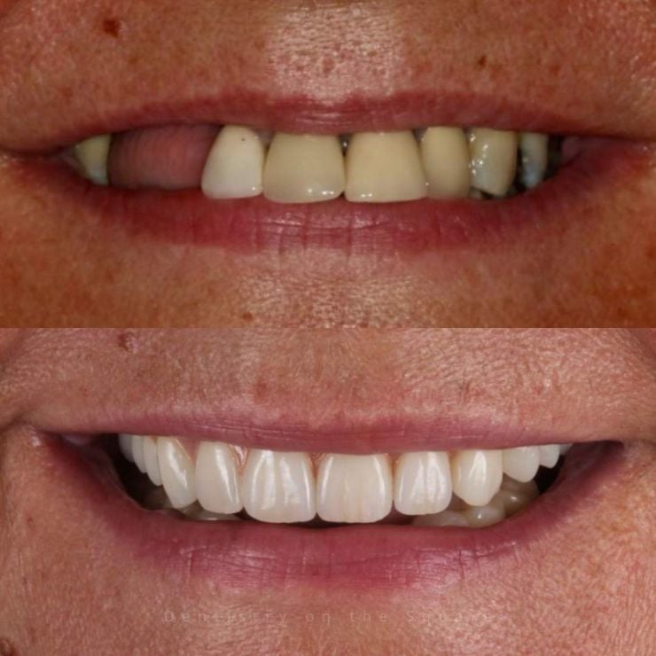 Transforming Smiles
