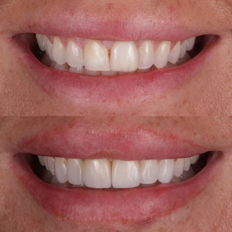 Transforming Smiles