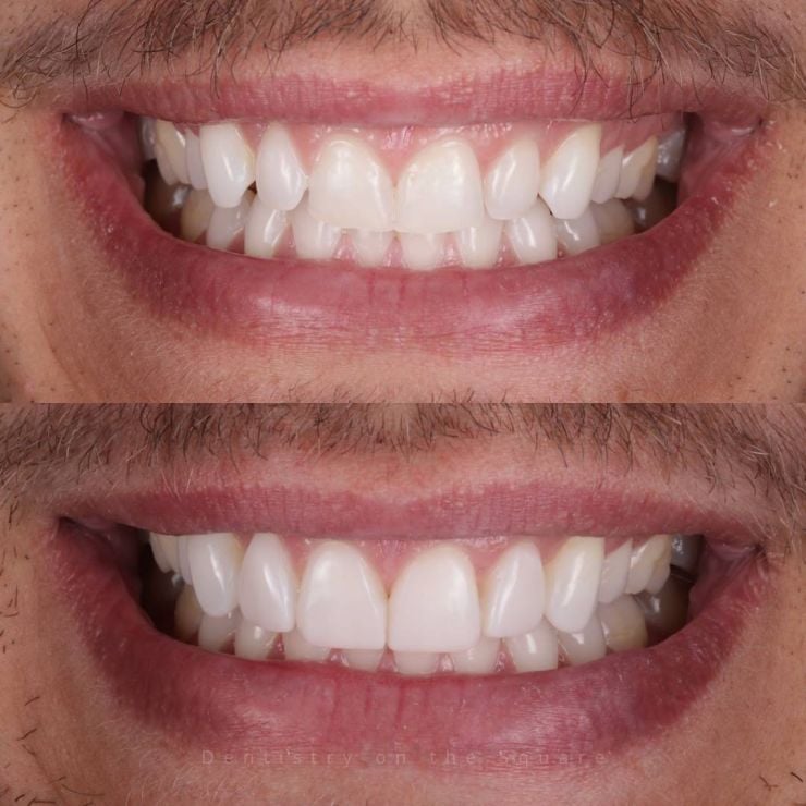 Transforming Smiles