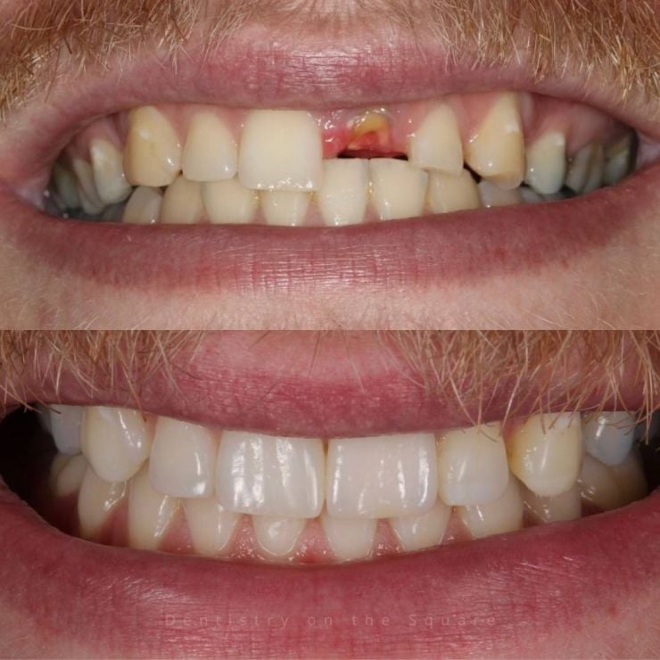 Transforming Smiles