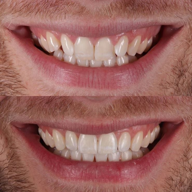 Transforming Smiles