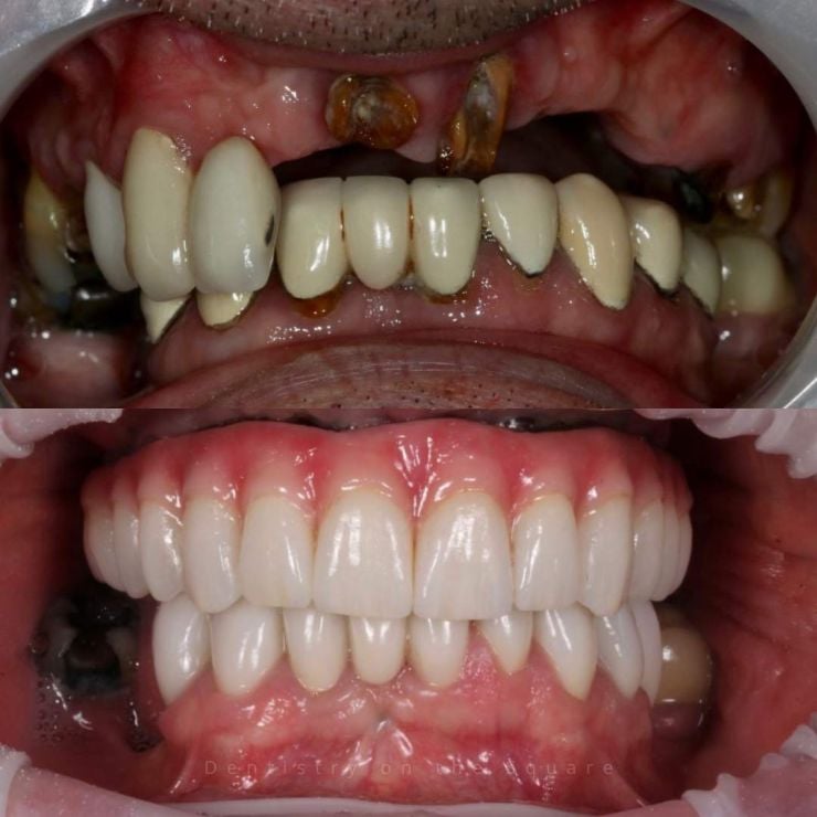 Transforming Smiles