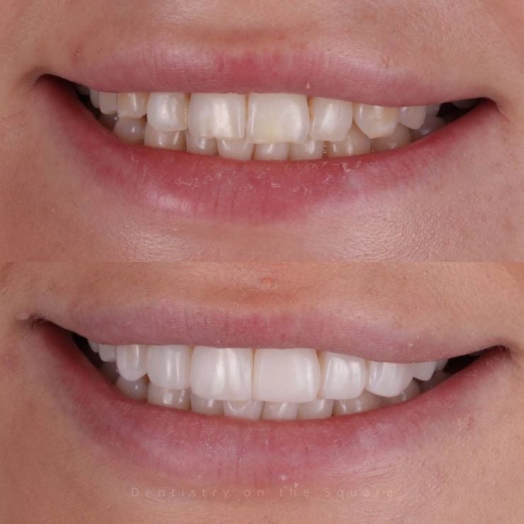 Transforming Smiles