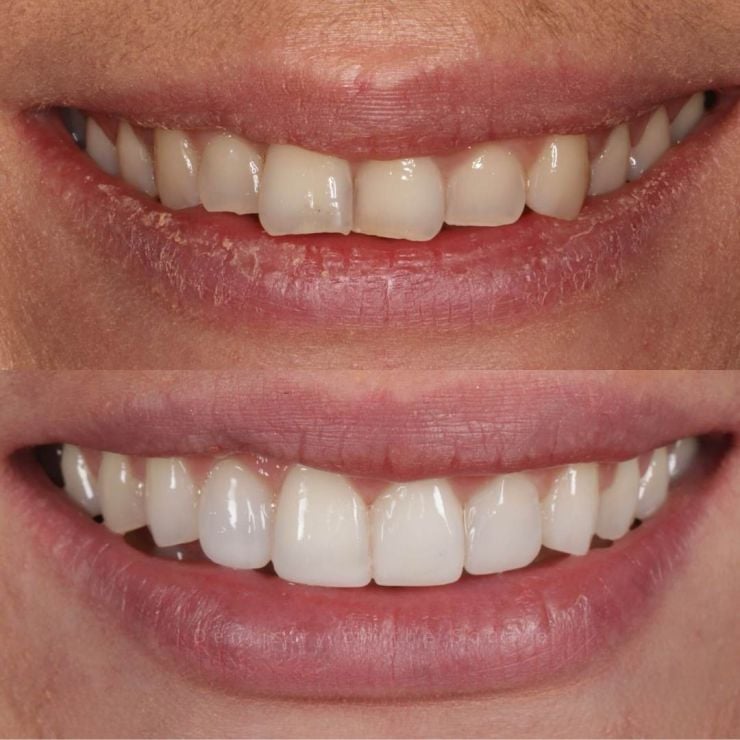 Dentistry On The Square, Pain Free Dentist Glasgow - Smile Gallery
