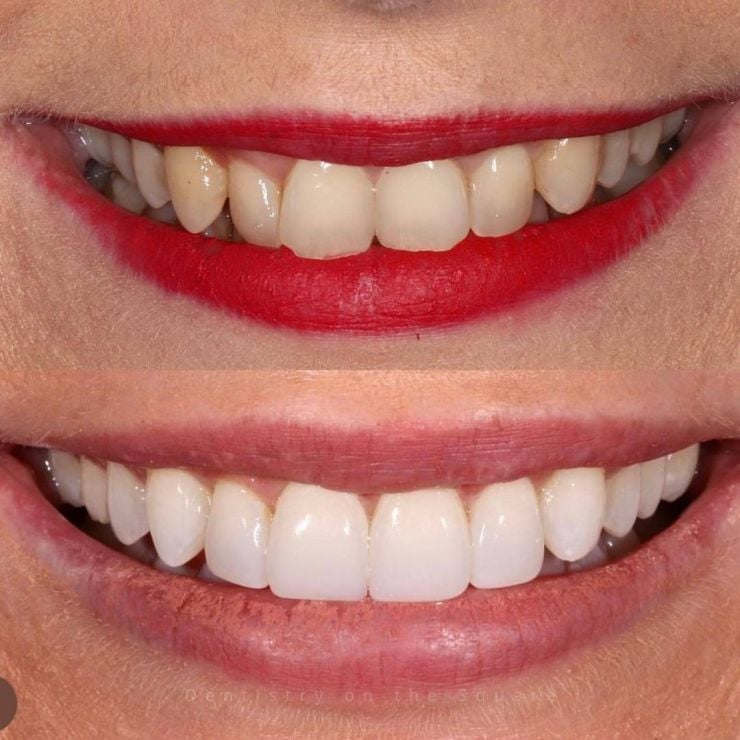 Transforming Smiles