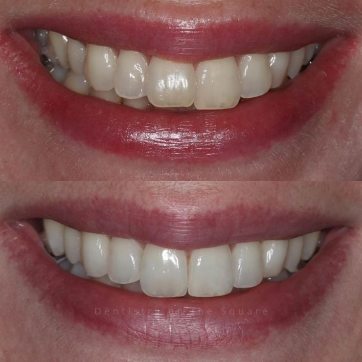 Dentistry On The Square, Pain Free Dentist Glasgow - Smile Gallery
