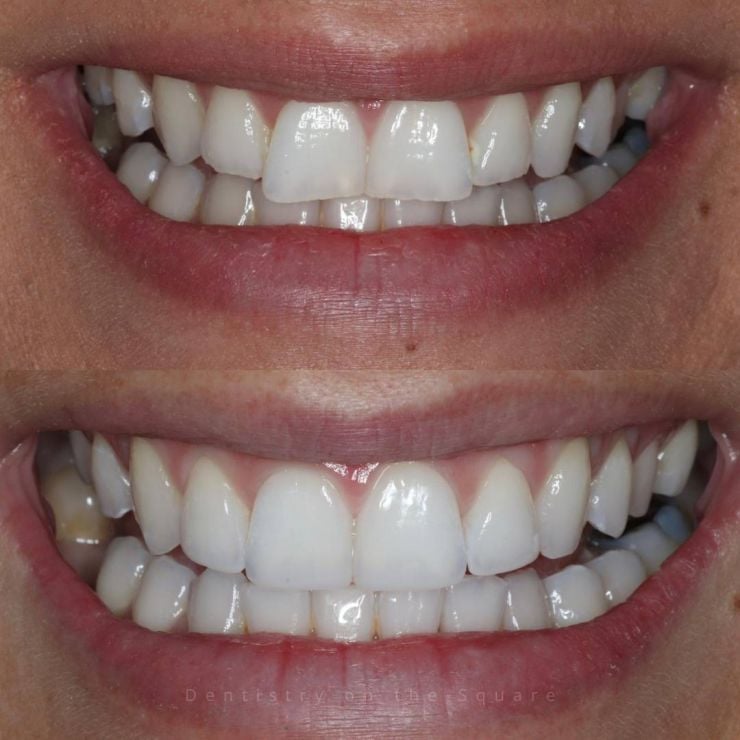 Transforming Smiles