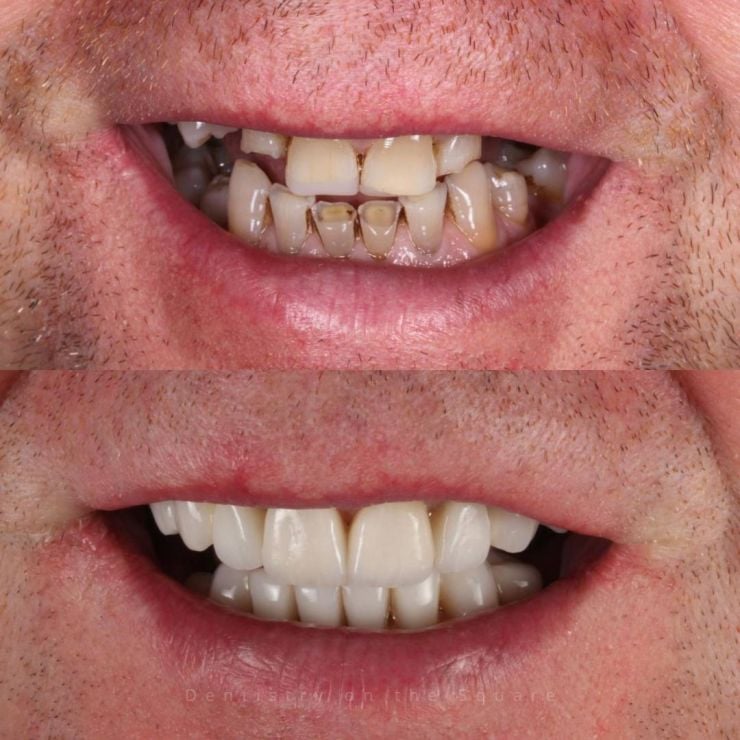 Transforming Smiles