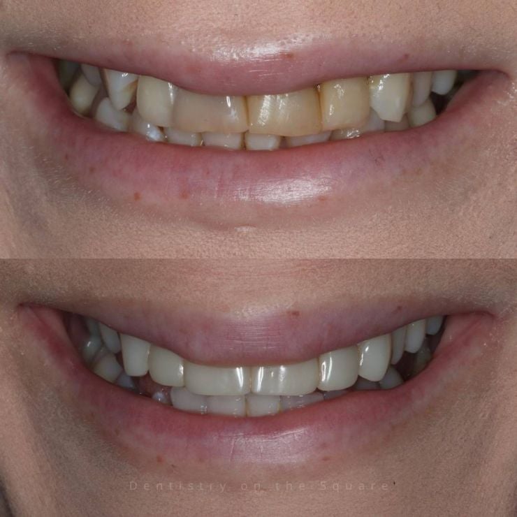 Transforming Smiles