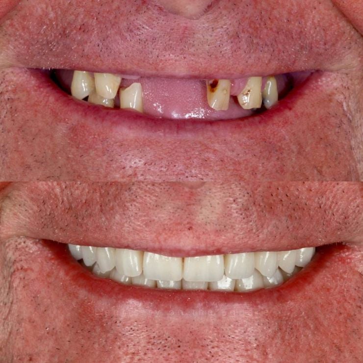 Dentistry On The Square, Pain Free Dentist Glasgow - Smile Gallery