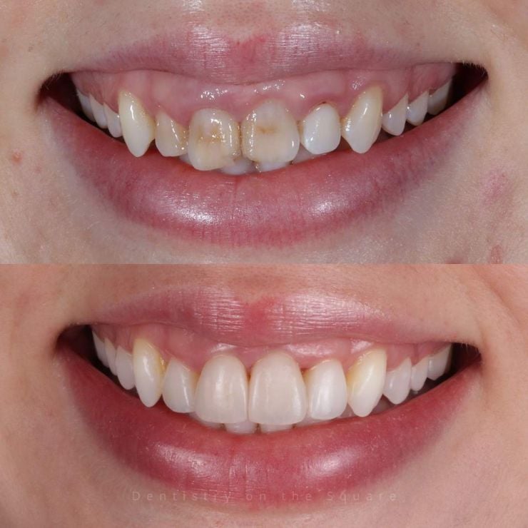 Transforming Smiles