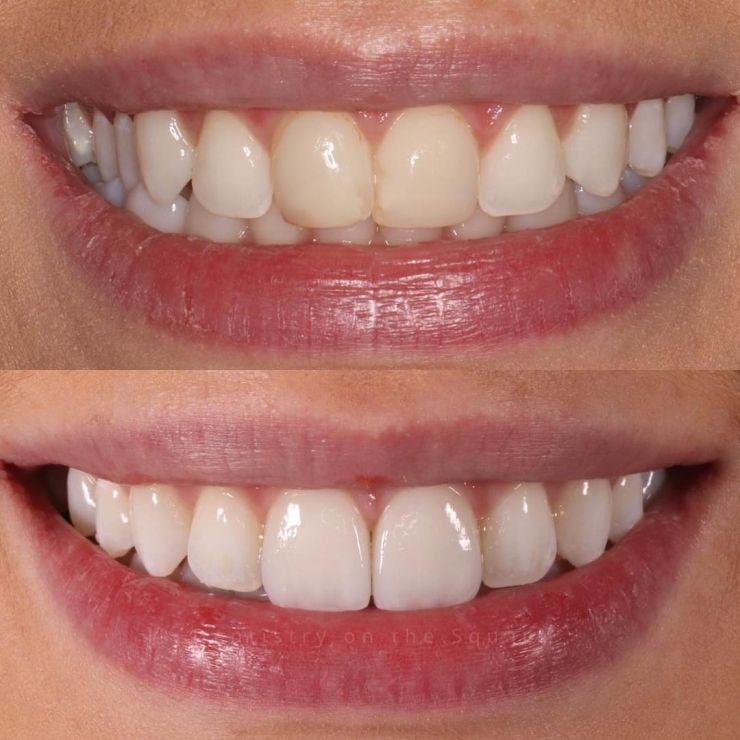 Dentistry On The Square, Pain Free Dentist Glasgow - Smile Gallery