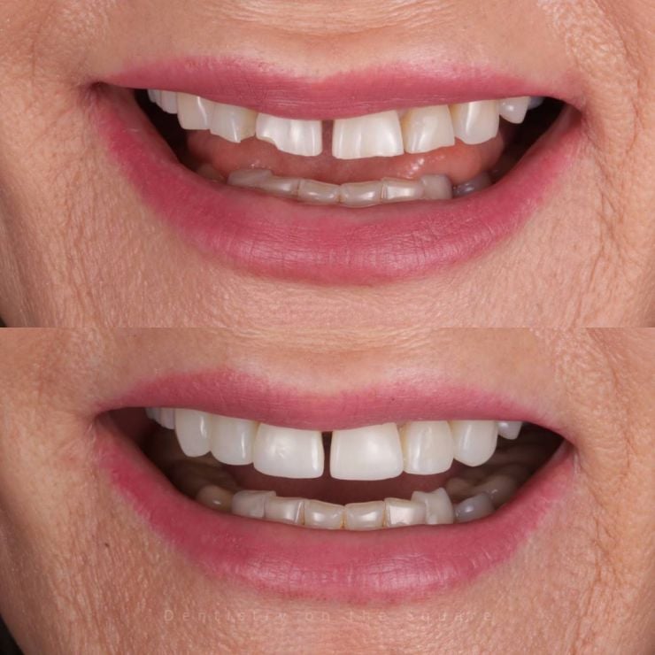 Transforming Smiles