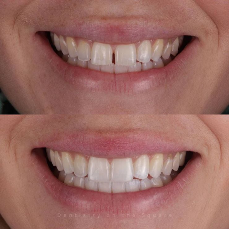 Dentistry On The Square, Pain Free Dentist Glasgow - Smile Gallery
