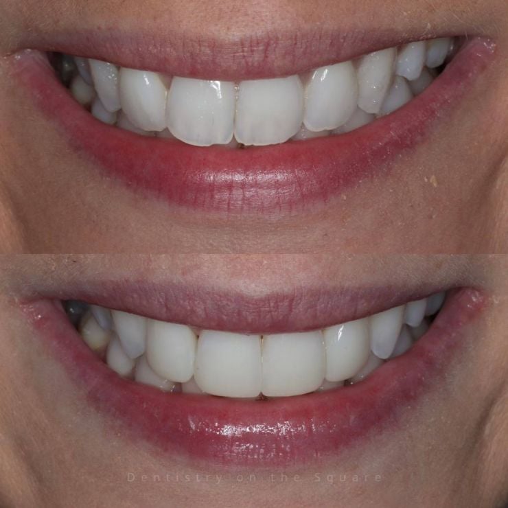 Transforming Smiles