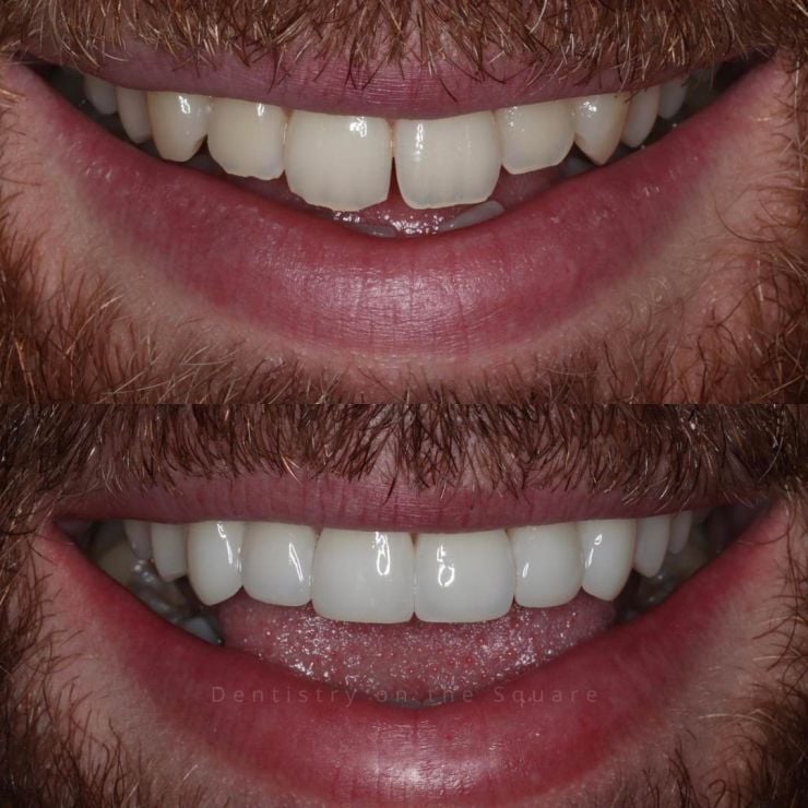 Dentistry On The Square, Pain Free Dentist Glasgow - Smile Gallery