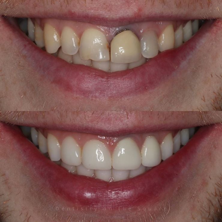 Transforming Smiles