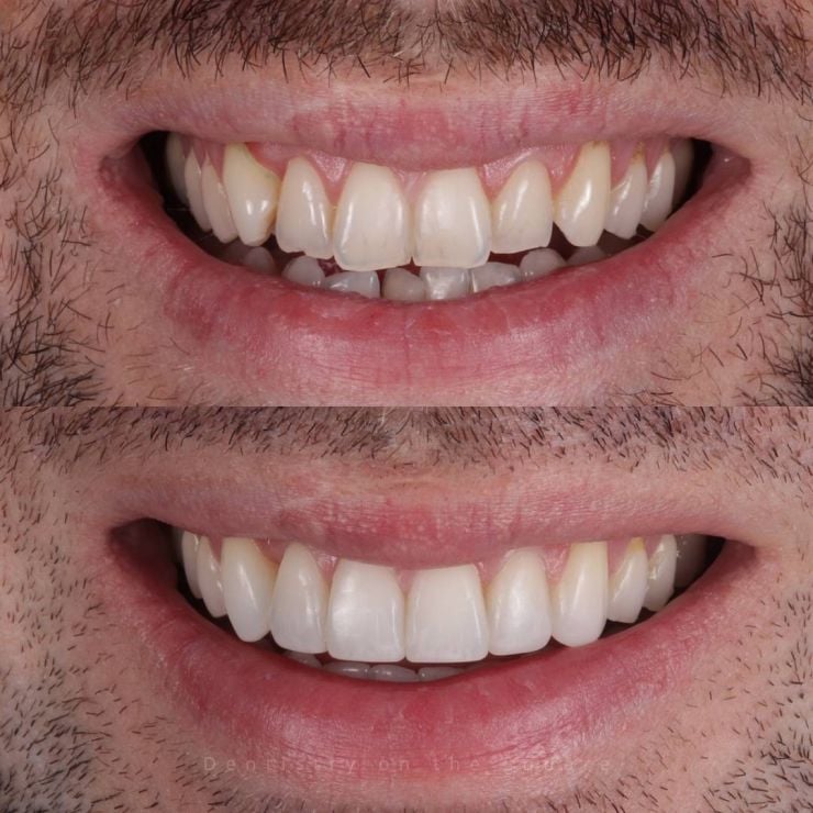 Transforming Smiles