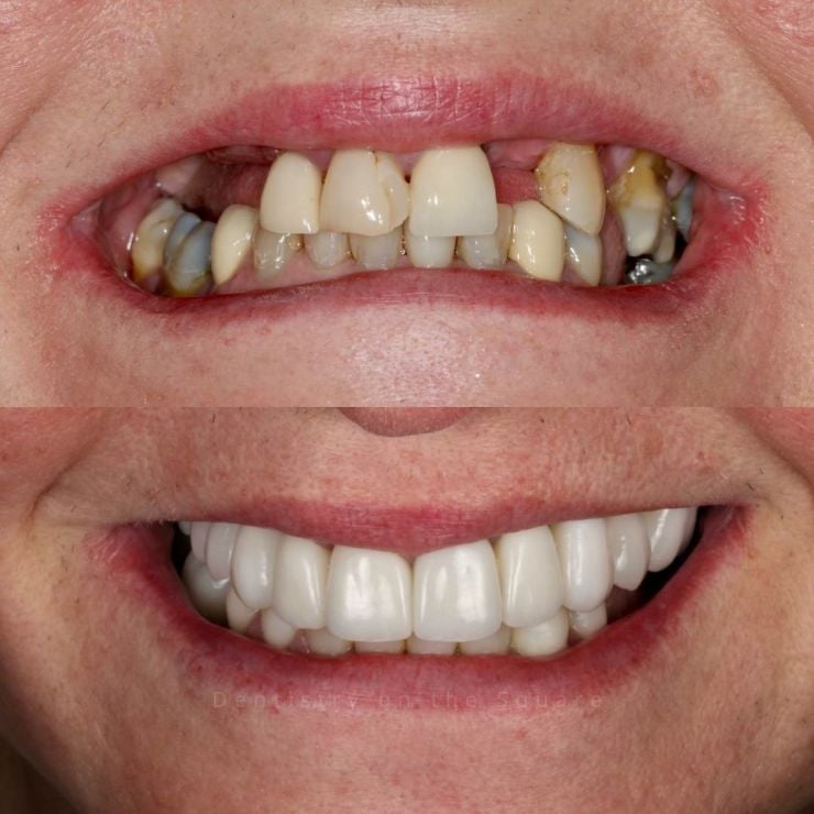 Dentistry On The Square, Pain Free Dentist Glasgow - Smile Gallery