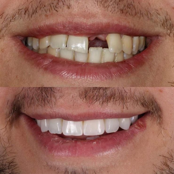 Transforming Smiles