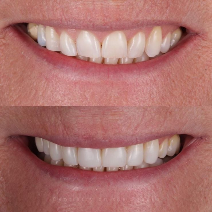 Transforming Smiles