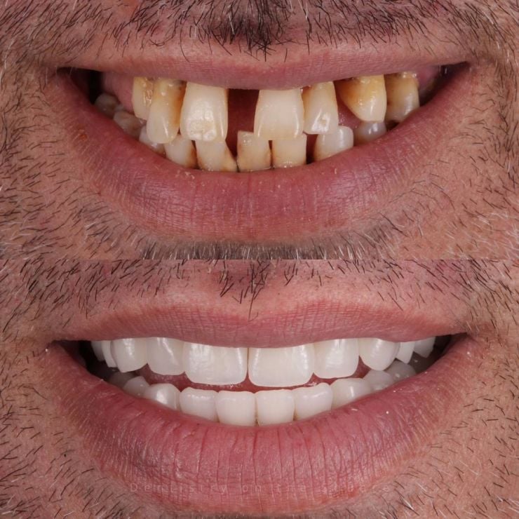 Transforming Smiles
