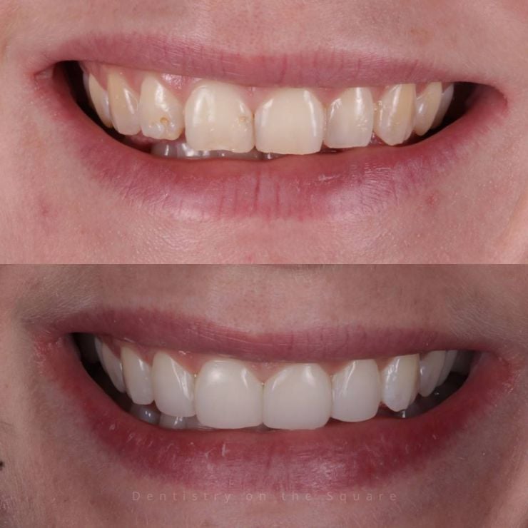 Transforming Smiles