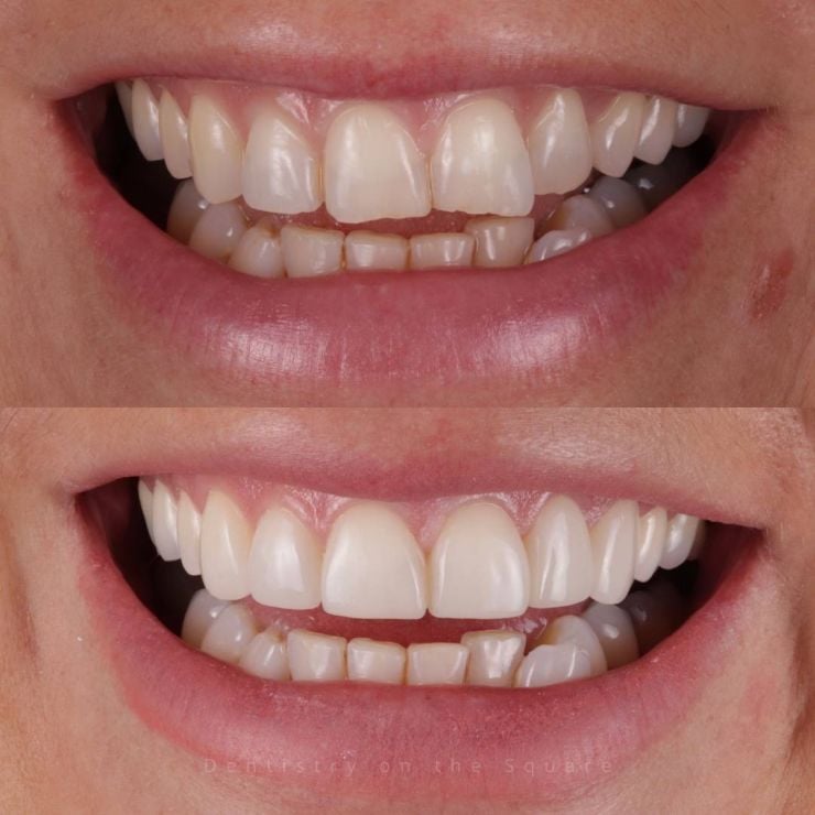 Transforming Smiles