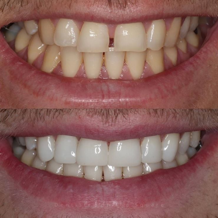 Dentistry On The Square, Pain Free Dentist Glasgow - Smile Gallery