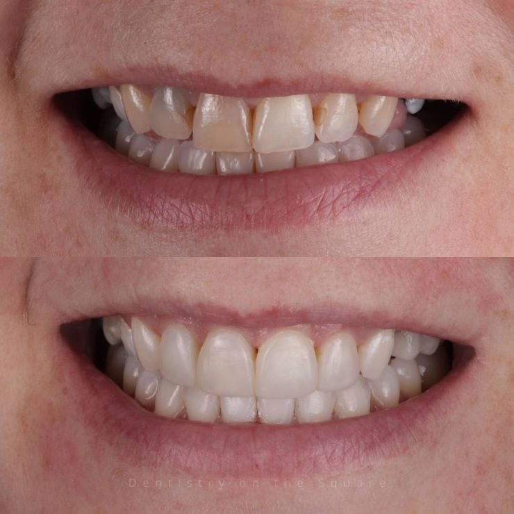 Transforming Smiles