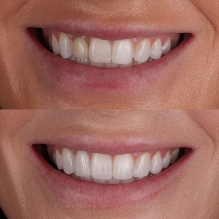 Dentistry On The Square, Pain Free Dentist Glasgow - Smile Gallery