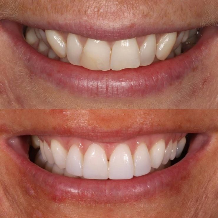 Transforming Smiles